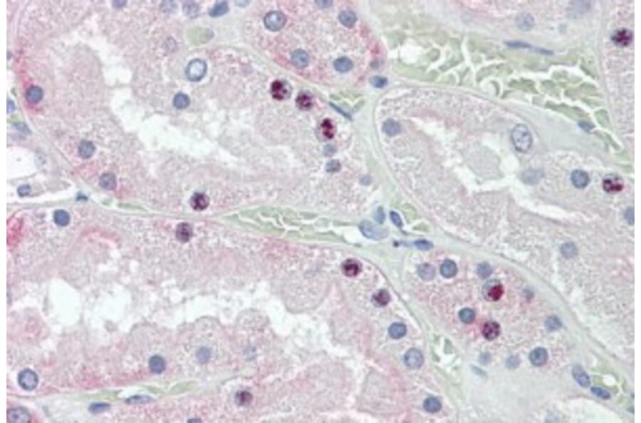 Immunohistochemistry - Anti-HOXD10 Antibody (A84582) - Antibodies.com