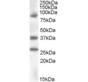 Western Blot - Anti-HOXD10 Antibody (A84582) - Antibodies.com