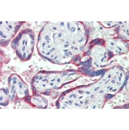 Immunohistochemistry - Anti-NOX2 Antibody (A84584) - Antibodies.com