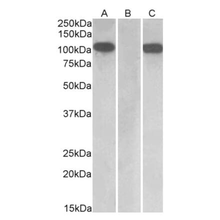 Western Blot - Anti-FURIN Antibody (A84585) - Antibodies.com