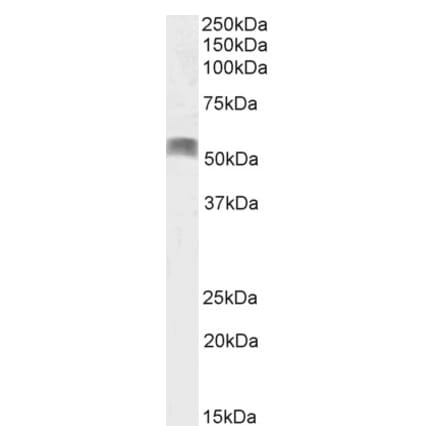 Western Blot - Anti-Arx Antibody (A84586) - Antibodies.com