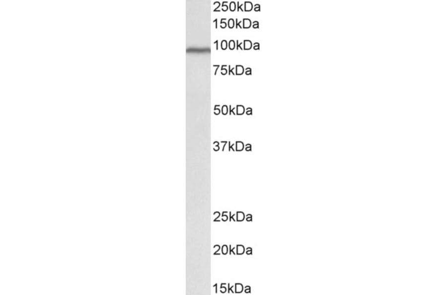 Western Blot - Anti-Cullin 3/CUL-3 Antibody (A84587) - Antibodies.com