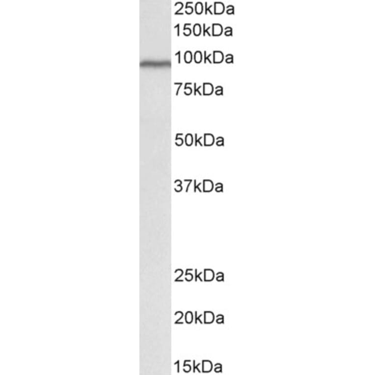 Western Blot - Anti-Cullin 3/CUL-3 Antibody (A84587) - Antibodies.com