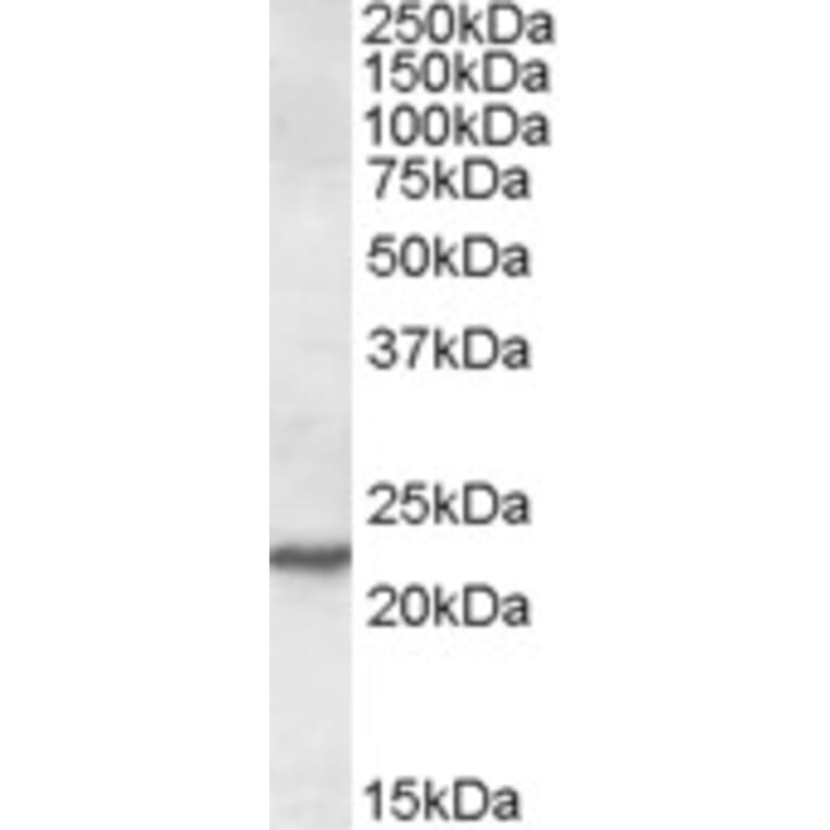 Western Blot - Anti-SAR1 Antibody (A84589) - Antibodies.com