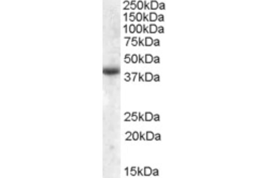 Western Blot - Anti-APOL6 Antibody (A84593) - Antibodies.com