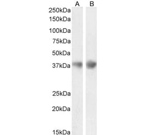 Western Blot - Anti-Clusterin Antibody (A84594) - Antibodies.com