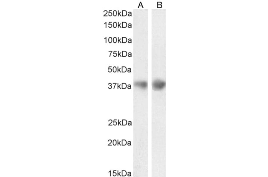 Western Blot - Anti-Clusterin Antibody (A84594) - Antibodies.com