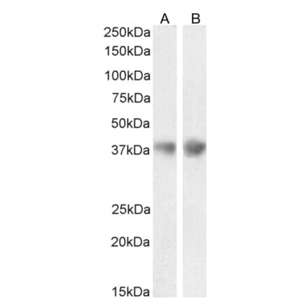 Western Blot - Anti-Clusterin Antibody (A84594) - Antibodies.com