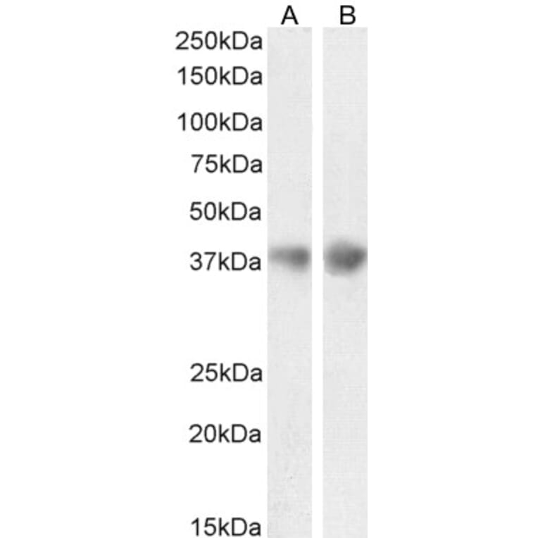 Western Blot - Anti-Clusterin Antibody (A84594) - Antibodies.com