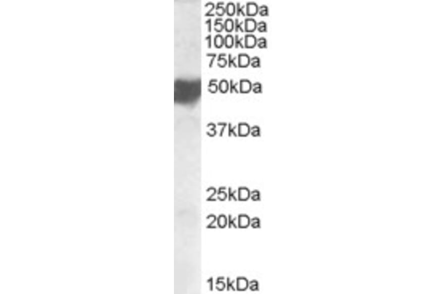 Western Blot - Anti-ASAM Antibody (A84595) - Antibodies.com
