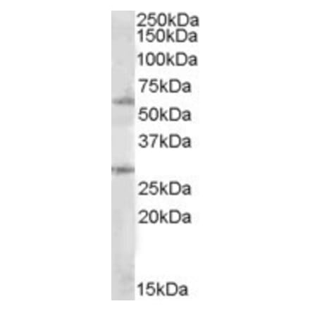 Western Blot - Anti-SOCS7 Antibody (A84596) - Antibodies.com