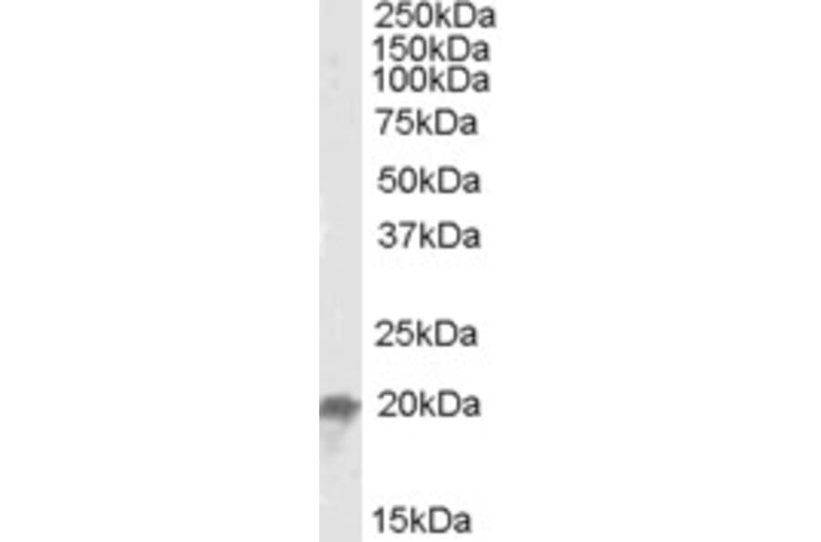 Western Blot - Anti-NCE2/UBE2F Antibody (A84600) - Antibodies.com