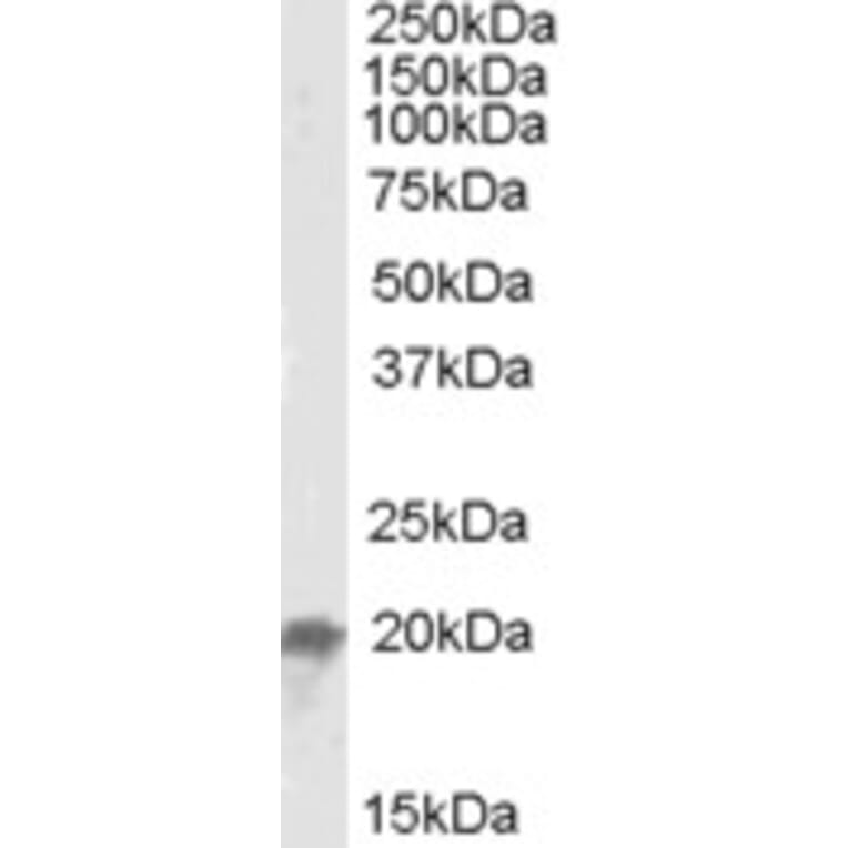 Western Blot - Anti-NCE2/UBE2F Antibody (A84600) - Antibodies.com