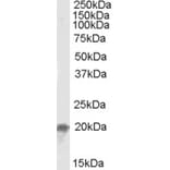 Western Blot - Anti-NCE2/UBE2F Antibody (A84600) - Antibodies.com