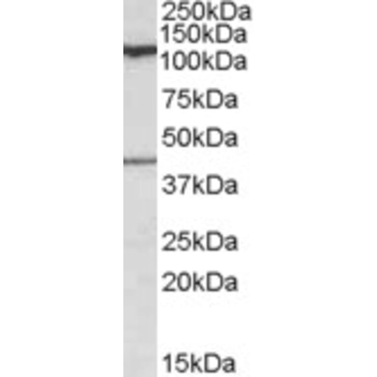 Western Blot - Anti-COG1 Antibody (A84601) - Antibodies.com