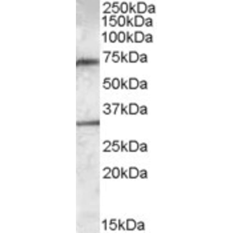 Western Blot - Anti-LIPG Antibody (A84603) - Antibodies.com