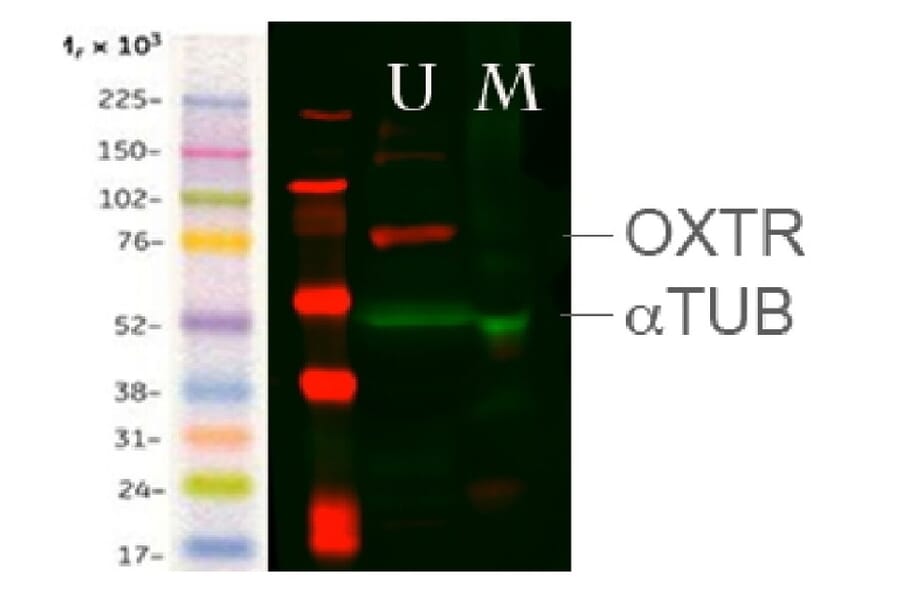 Western Blot - Anti-OXTR Antibody (A84606) - Antibodies.com