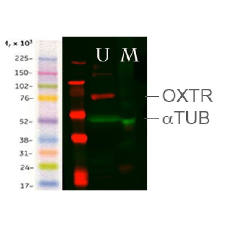 Western Blot - Anti-OXTR Antibody (A84606) - Antibodies.com