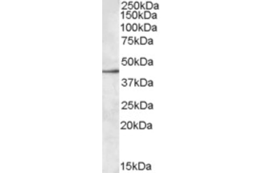 Western Blot - Anti-SIGLEC8 Antibody (A84608) - Antibodies.com