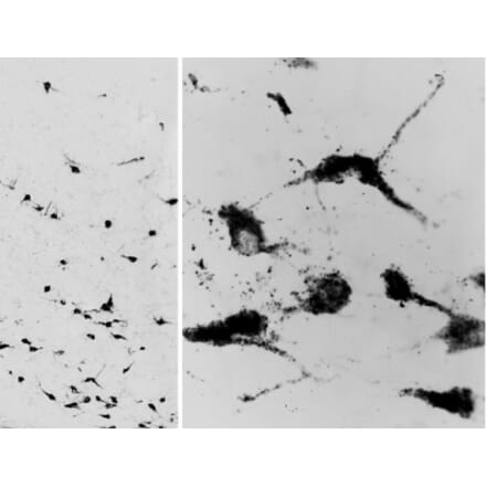 Immunohistochemistry - Anti-Oxytocin-neurophysin 1 Antibody (A84611) - Antibodies.com