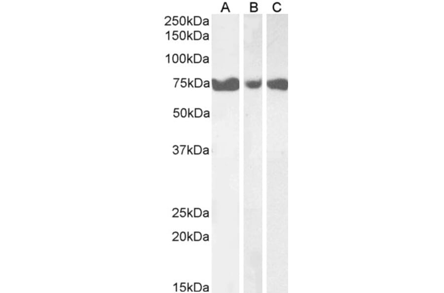 Western Blot - Anti-ITPKC Antibody (A84612) - Antibodies.com