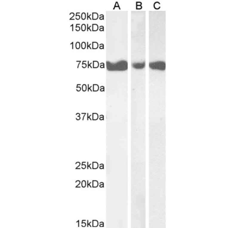 Western Blot - Anti-ITPKC Antibody (A84612) - Antibodies.com