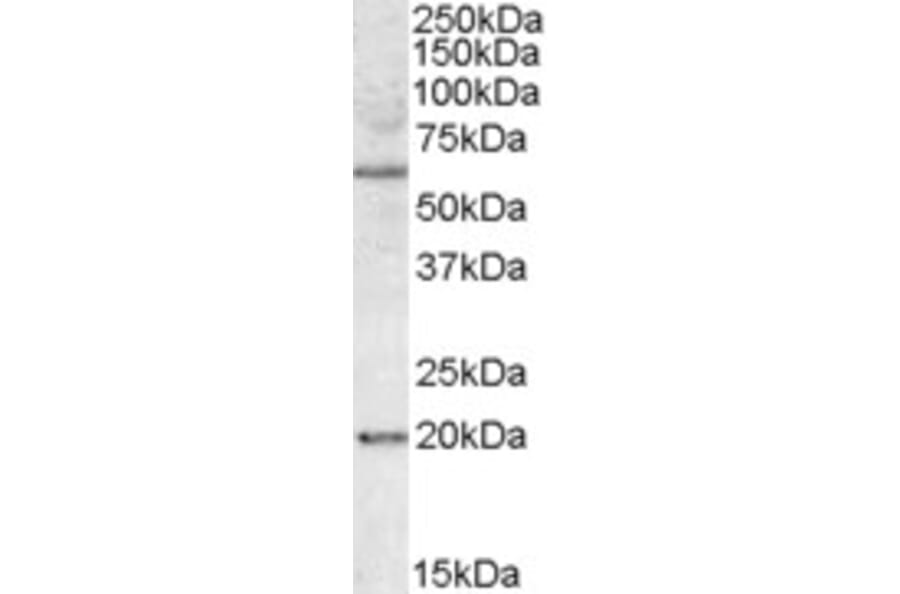 Western Blot - Anti-SODD Antibody (A84613) - Antibodies.com