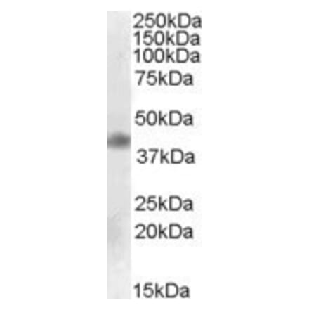 Western Blot - Anti-MEIS1 Antibody (A84614) - Antibodies.com