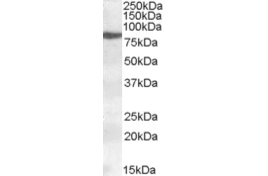 Western Blot - Anti-15 Lipoxygenase 1 Antibody (A84615) - Antibodies.com