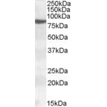 Western Blot - Anti-15 Lipoxygenase 1 Antibody (A84615) - Antibodies.com