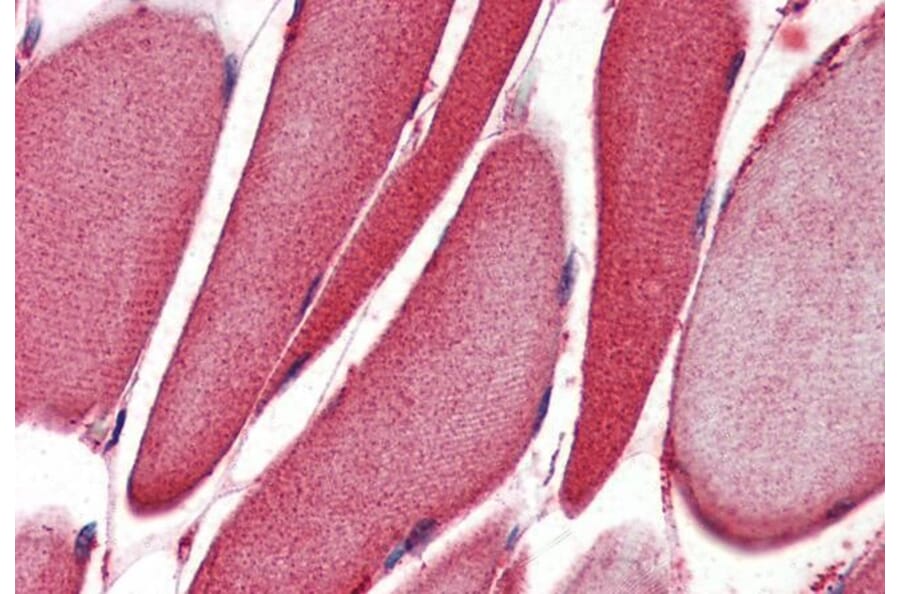 Immunohistochemistry - Anti-15 Lipoxygenase 1 Antibody (A84615) - Antibodies.com
