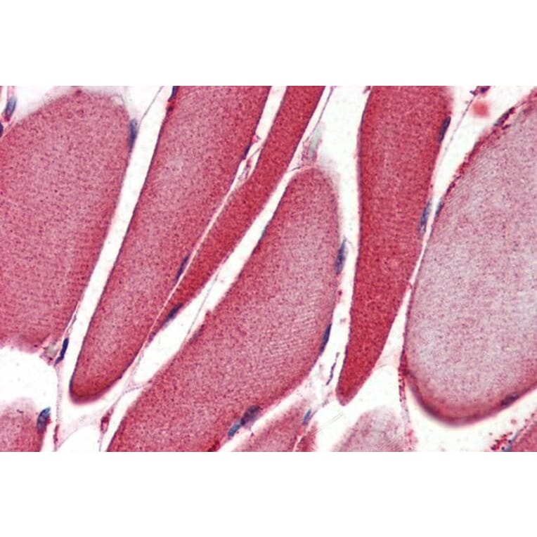 Immunohistochemistry - Anti-15 Lipoxygenase 1 Antibody (A84615) - Antibodies.com