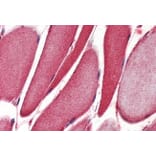 Immunohistochemistry - Anti-15 Lipoxygenase 1 Antibody (A84615) - Antibodies.com