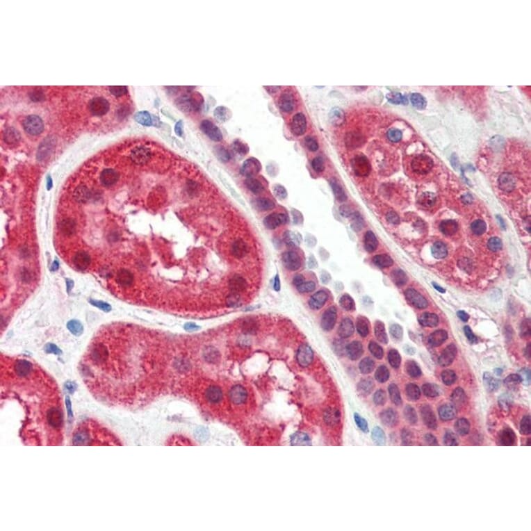 Immunohistochemistry - Anti-15 Lipoxygenase 1 Antibody (A84615) - Antibodies.com