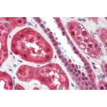 Immunohistochemistry - Anti-15 Lipoxygenase 1 Antibody (A84615) - Antibodies.com