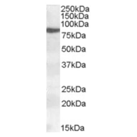 Western Blot - Anti-ALOX15 Antibody (A84615) - Antibodies.com