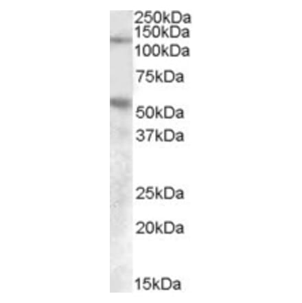 Western Blot - Anti-Palladin Antibody (A84616) - Antibodies.com