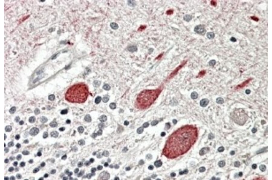 Immunohistochemistry - Anti-Melatonin Receptor 1B/MTNR1B Antibody (A84619) - Antibodies.com