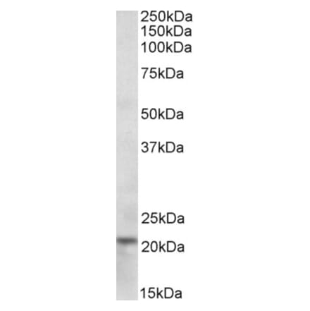 Western Blot - Anti-Ferritin Heavy Chain Antibody (A84621) - Antibodies.com