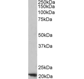 Western Blot - Anti-FTH1 Antibody (A84621) - Antibodies.com