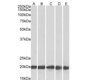 Western Blot - Anti-Ferritin Light Chain Antibody (A84622) - Antibodies.com