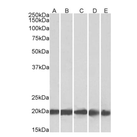 Western Blot - Anti-Ferritin Light Chain Antibody (A84622) - Antibodies.com