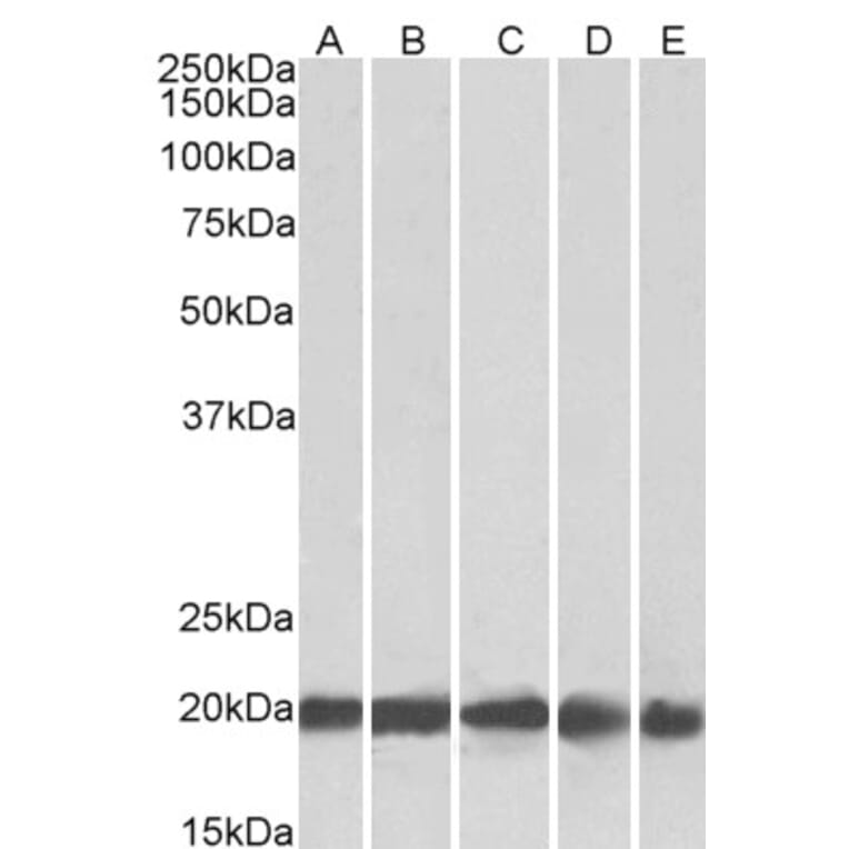 Western Blot - Anti-Ferritin Light Chain Antibody (A84622) - Antibodies.com