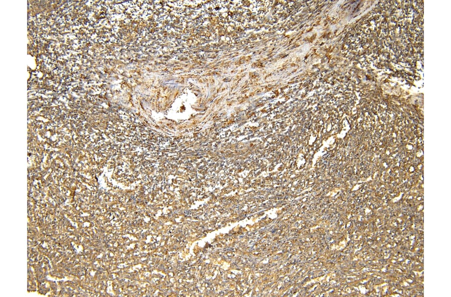 Immunohistochemistry - Anti-Ferritin Light Chain Antibody (A84622) - Antibodies.com