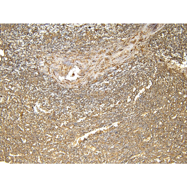 Immunohistochemistry - Anti-Ferritin Light Chain Antibody (A84622) - Antibodies.com