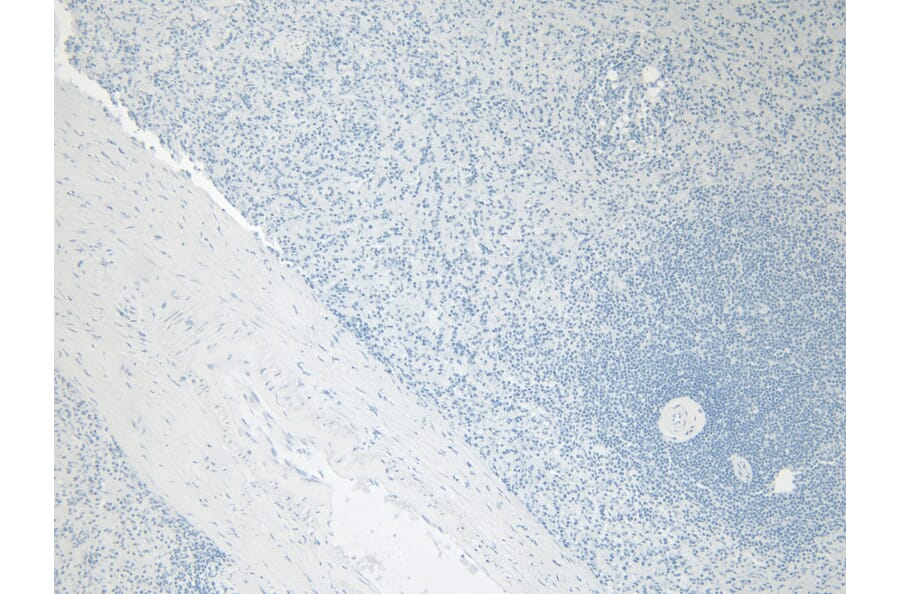 Immunohistochemistry - Anti-Ferritin Light Chain Antibody (A84622) - Antibodies.com