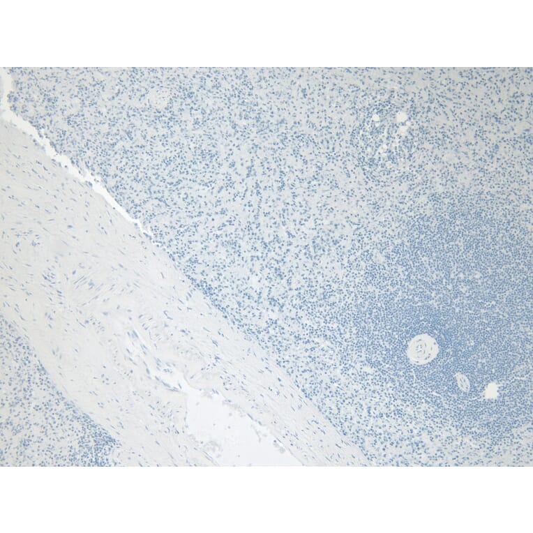 Immunohistochemistry - Anti-Ferritin Light Chain Antibody (A84622) - Antibodies.com