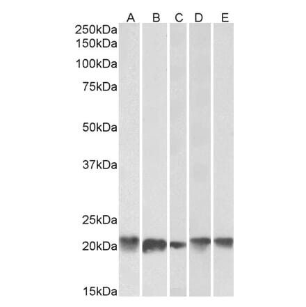 Western Blot - Anti-FTL Antibody (A84622) - Antibodies.com