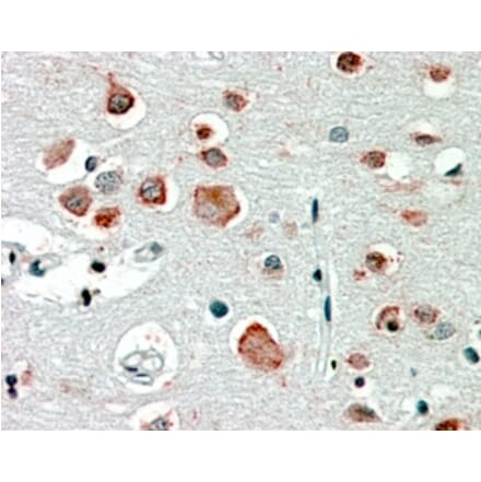 Immunohistochemistry - Anti-GABRA4 Antibody (A84624) - Antibodies.com