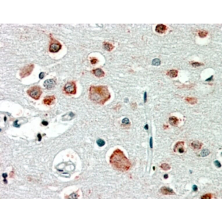 Immunohistochemistry - Anti-GABRA4 Antibody (A84624) - Antibodies.com